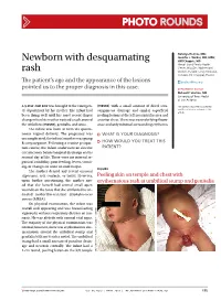 Newborn with Desquamating Rash