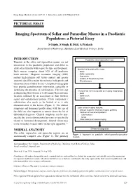 Imaging Spectrum of Sellar and Parasellar Masses in a Paediatric