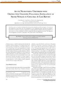 Acute Necrotizing Ureteritis with Obstructive Uropathy Following Instillation of Silver Nitrate in Chyluria: a Case Report