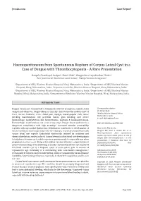 Haemoperitoneum from Spontaneous Rupture of Corpus Luteal Cyst in a Case of Dengue with Thrombocytopenia - a Rare Presentation