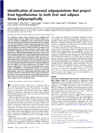 Identification of Neuronal Subpopulations That Project From