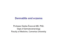 Dermatitis and Eczema