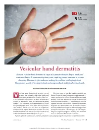 Vesicular Hand Dermatitis Abstract: Vesicular Hand Dermatitis Is a Type of Eczema Involving the ﬁ Ngers, Hands, and Sometimes the Feet