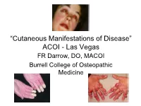 Dermatological Indications of Disease - Part II This Patient on Dialysis Is Showing: A