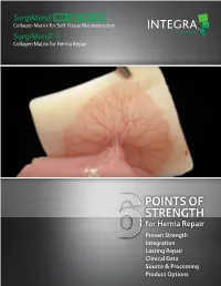 Points of Strength
