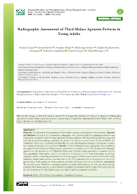 Radiographic Assessment of Third Molars Agenesis Patterns in Young Adults