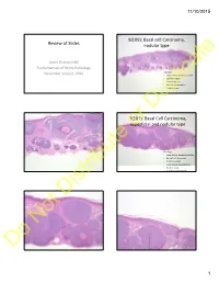 Basal Cell Carcinoma, Superficial and Nodular Typeor