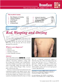 Red, Weeping and Oozing P.51 6