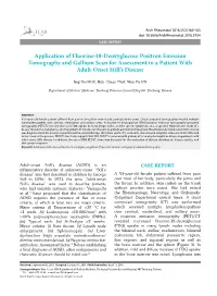 Application of Fluorine-18-Deoxyglucose Positron Emission Tomography and Gallium Scan for Assessment in a Patient with Adult-Onset Still’S Disease