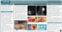 A Rare Case of Dermatofibrosarcoma Protuberans in the Lower