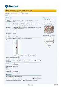 AP2B1 Monoclonal Antibody (M01), Clone 2D5