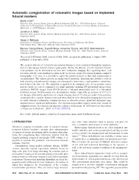 Automatic Coregistration of Volumetric Images Based on Implanted Fiducial