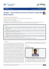 Tongue - Cause and Correction of Anterior Open Bite Malocclusion