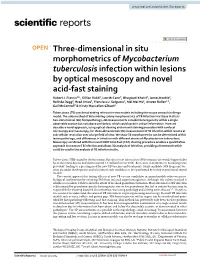 Three-Dimensional in Situ Morphometrics of Mycobacterium