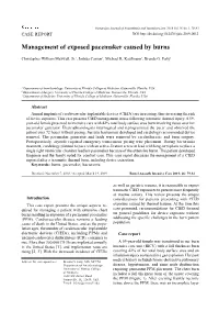 Management of Exposed Pacemaker Caused by Burns